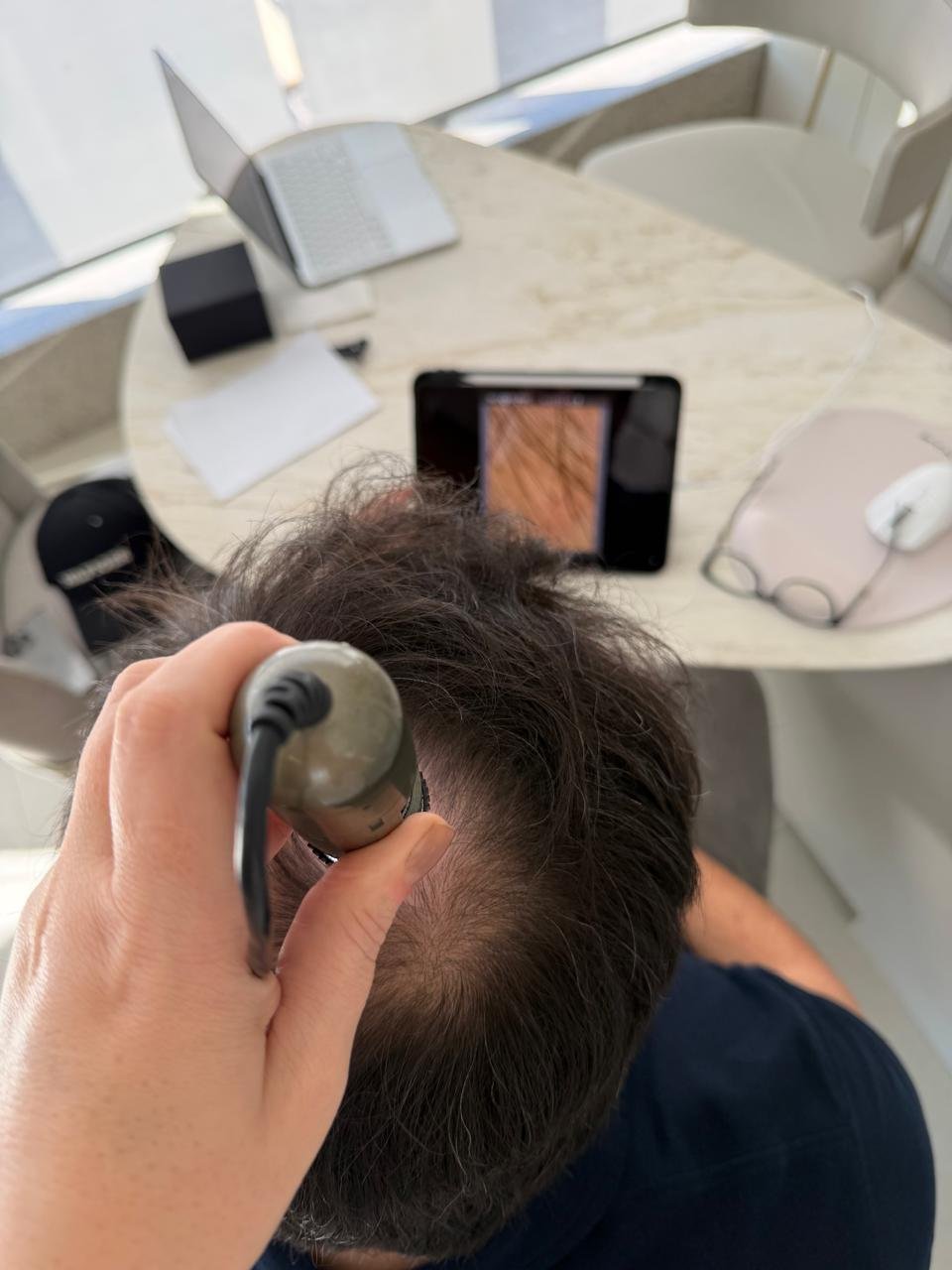 Avaliação do cabelo e couro cabeludo com tricoscopia